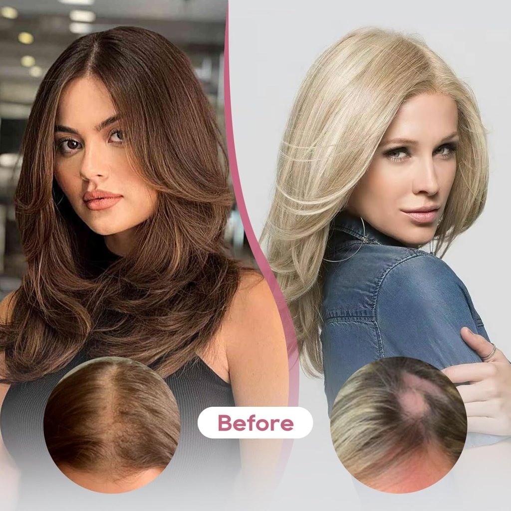 Real Human Hair Topper 10 inch Women Hair Toppers for Thinning Hair Light Grey Wigs